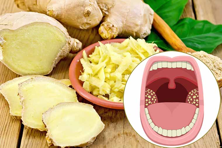 Nguyên nhân gây ra viêm họng cấp